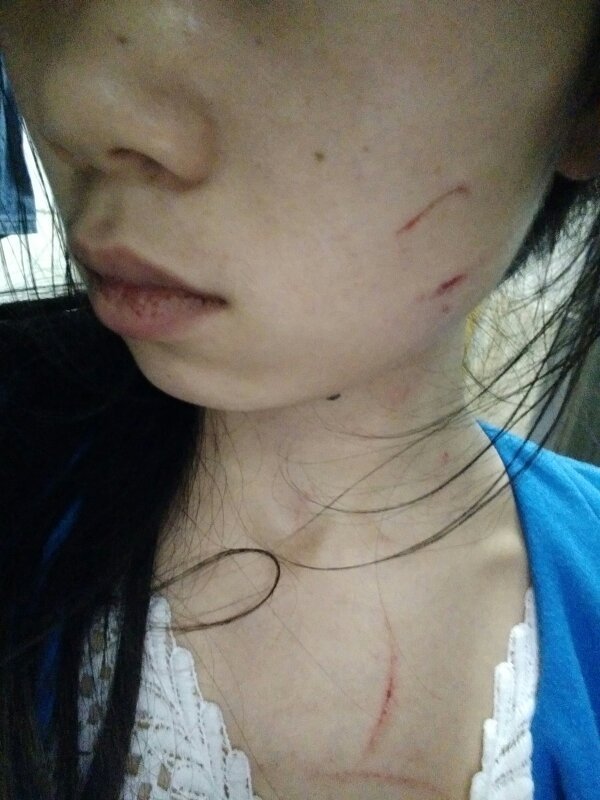 和一个女的打架了,是她先动手打我一巴掌,我没