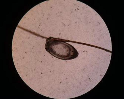 显微镜下的虱子图片