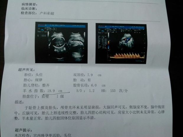 t01f0647c4891404305.jpg