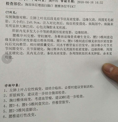 增强CT检查双侧胸廓对称,左肺上叶间后段见结