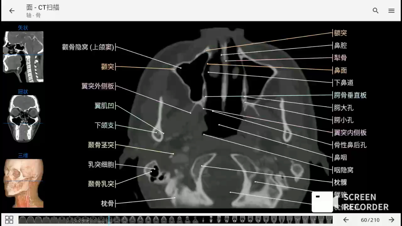 [图]影像解剖图谱神器 医学影像学必备 e-anatomy中文最新版 面部CT