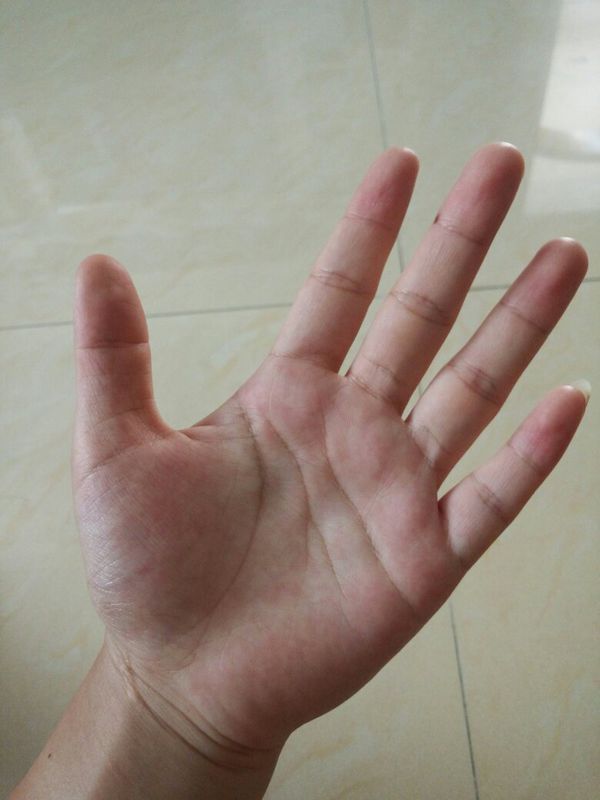 很烦恼,为什么我的手掌比同龄人大很多(我是女生),而且手指也粗