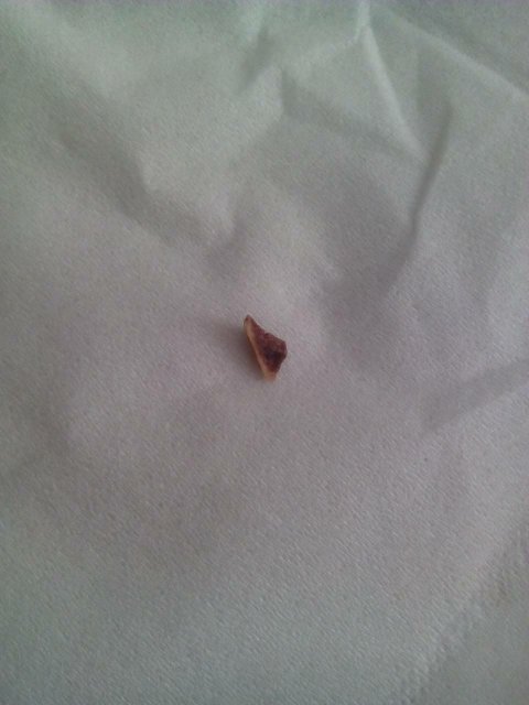 请问下大家这个是牙齿还是牙结石脱落的东西?